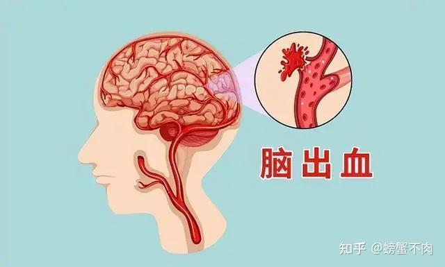 高血压的危害你注意了吗？
